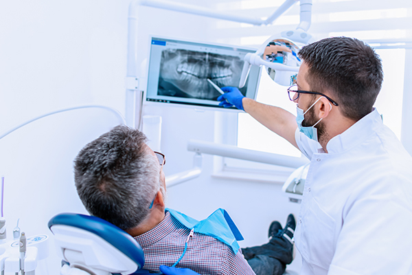 What Are Dental Implants?