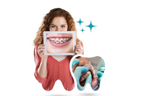 What Are Dental Braces?